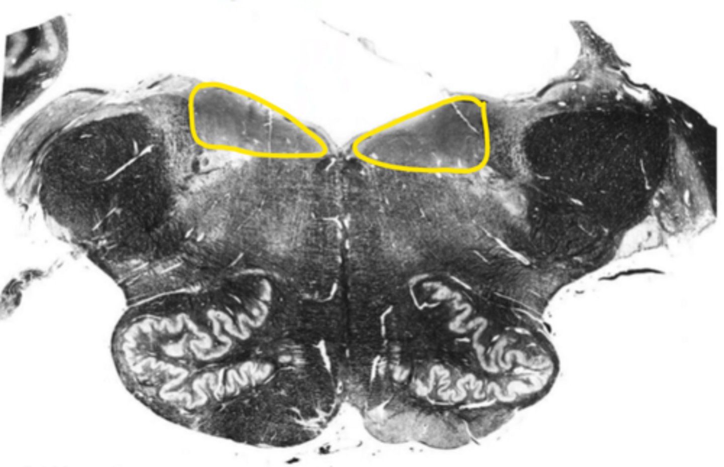 <p>ID the nucleus</p>