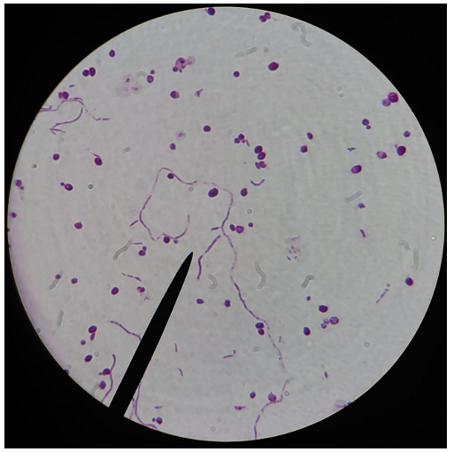 <p>What type of fungi is in this image, and what are the 2 examples.</p>