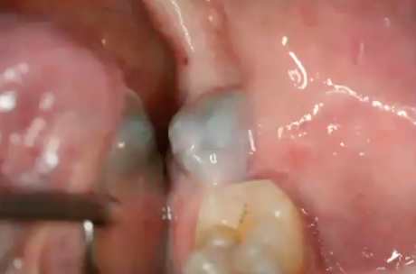 <p>what is the diagnosis </p>