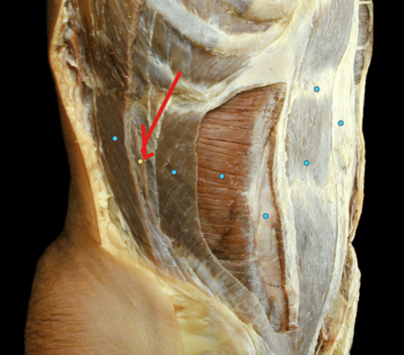knowt flashcard image