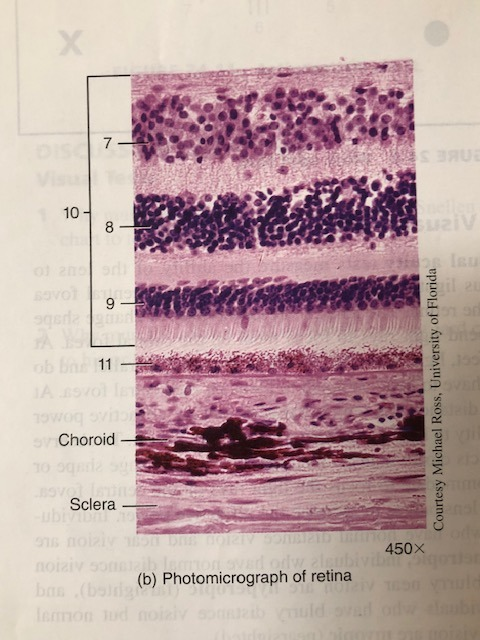 <p>locate Photoreceptor area of retina</p>