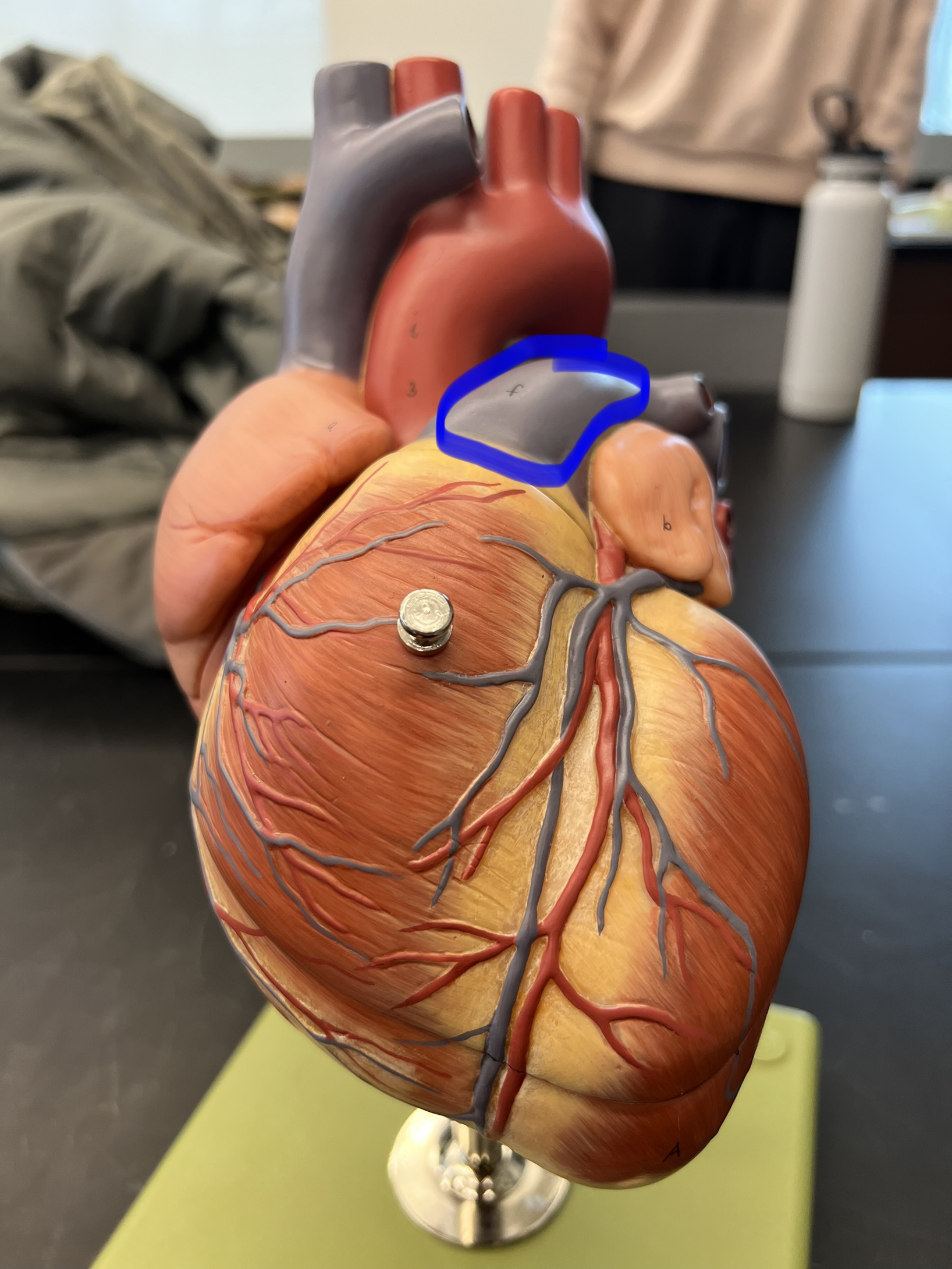 Name the heart structure.