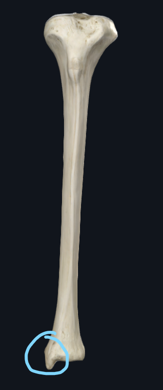 <p>What part of the tibia is this</p>
