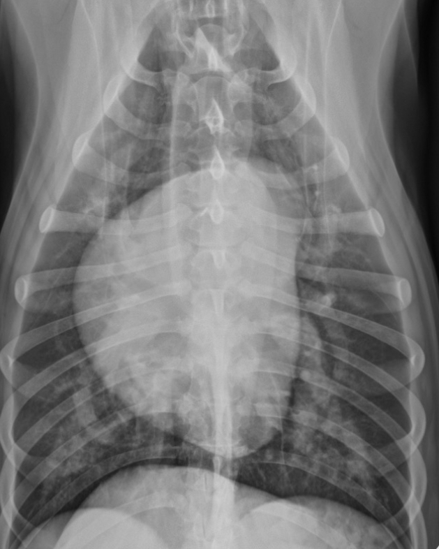 <p>What part of the heart is enlarged?</p>