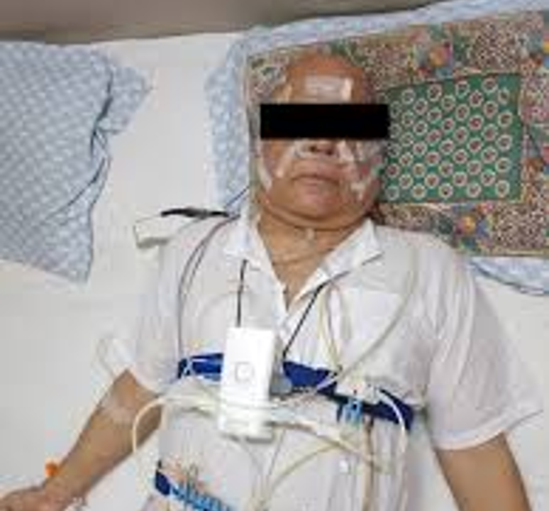 <p>What does this refer to </p><ul><li><p>With EEG and Esophageal Manometry</p></li><li><p>SpO2</p></li><li><p>Respiratory rate and effort</p><ul><li><p>Gas exchange</p></li></ul></li><li><p>Heart rate</p></li><li><p>Eye and leg movements</p></li><li><p>Muscle electrical activity</p></li><li><p>Body position</p></li></ul><p></p>