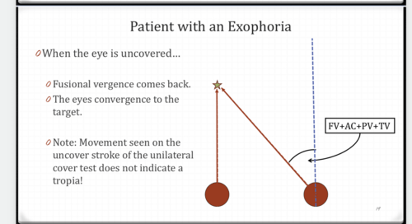 <p>Patient with an EXOphoria Example</p><p>When the eye is uncovered what happens?</p>