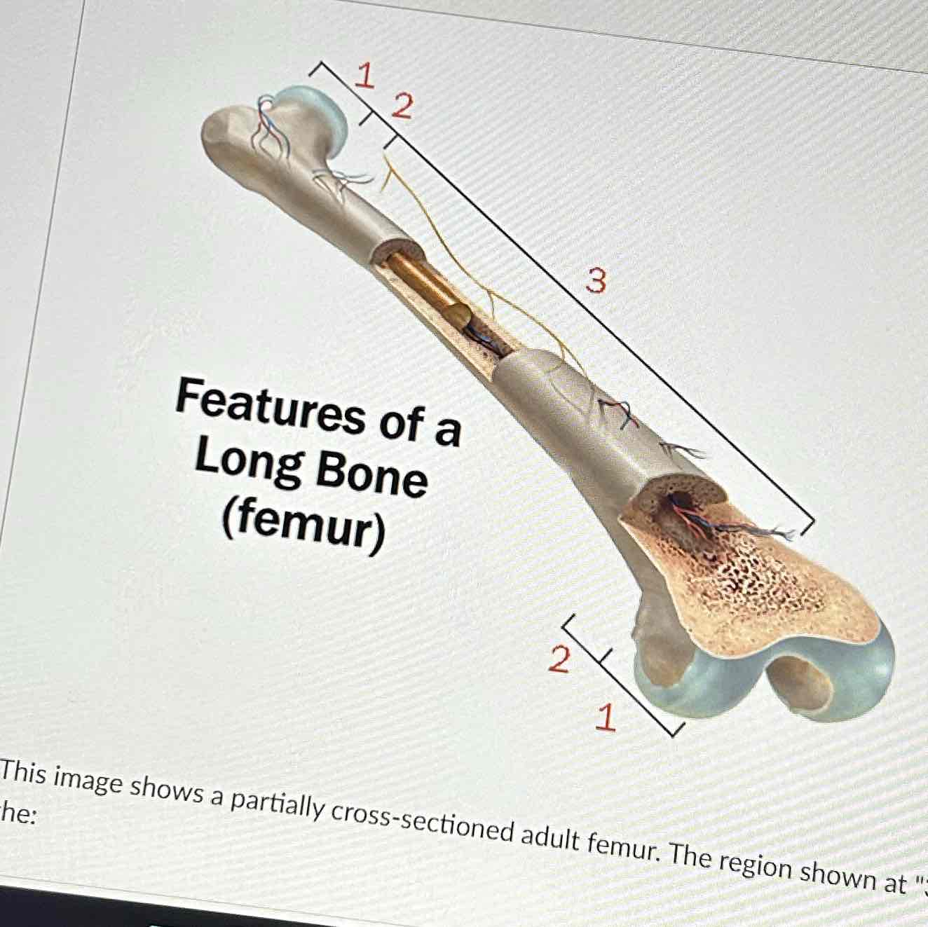 <p>The image shows a partially cross-sectioned adult femur. The region shown at “3” is the </p>