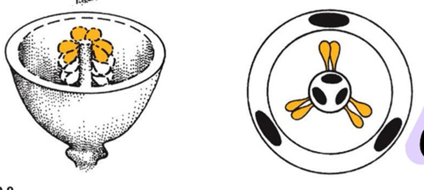 <p>Placentation type</p>