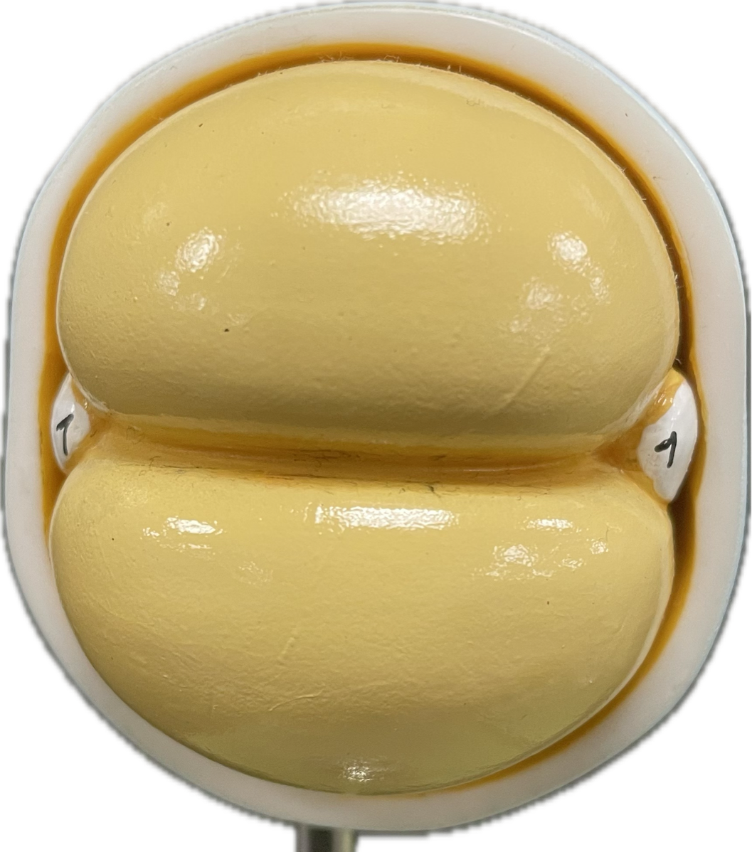 <p>Bicellular stage</p>