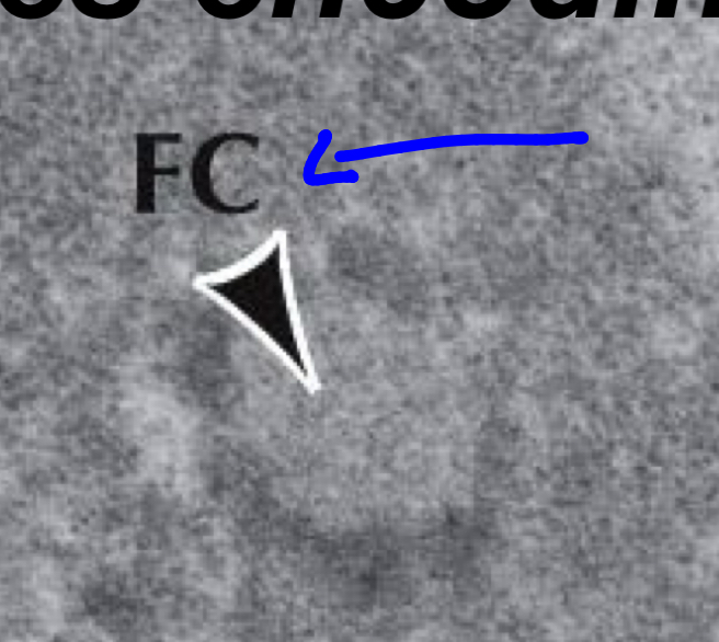<p>Fibrillation center</p>