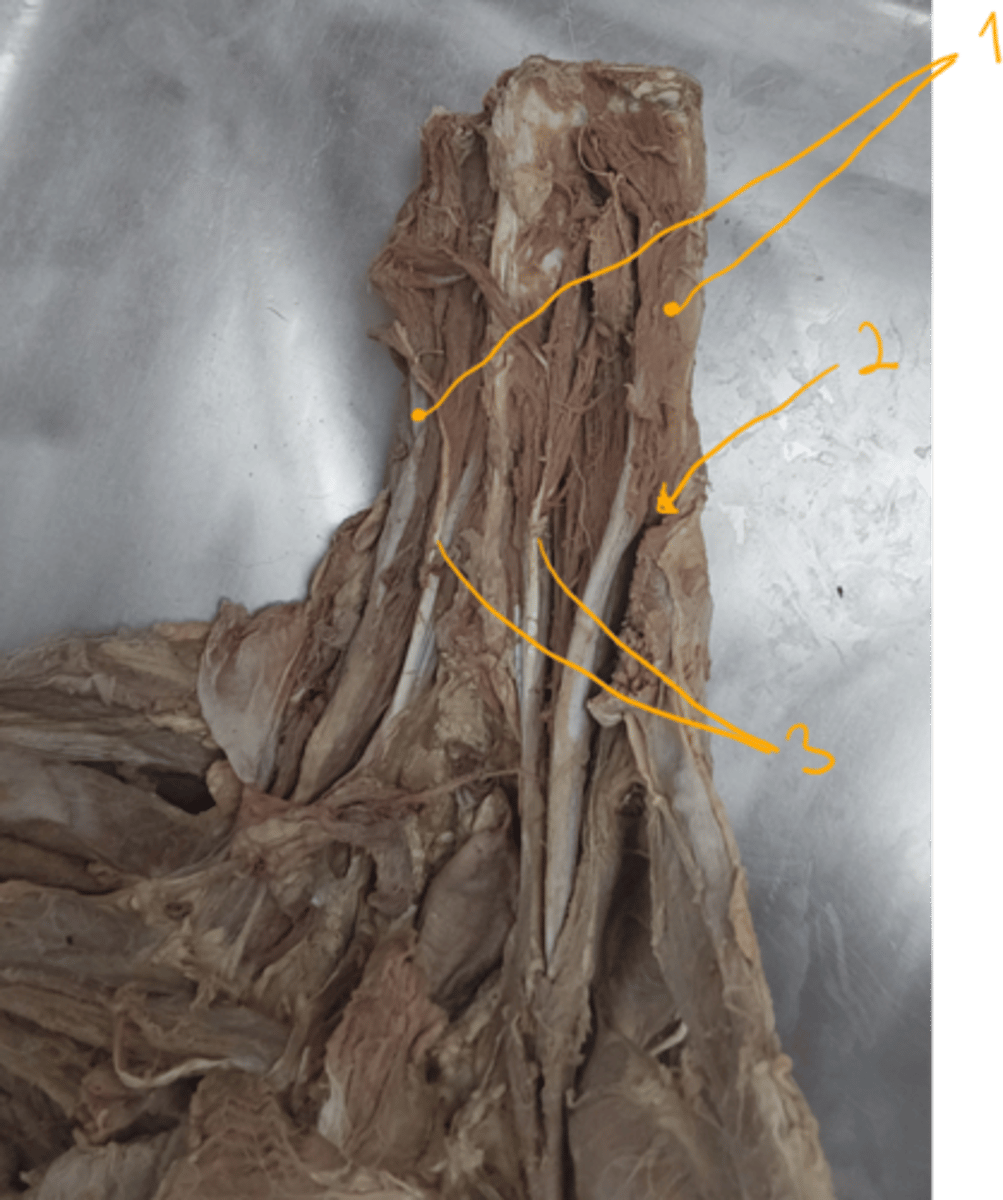 <p>identify the muscles. which type of muscle are these considered to be?</p>