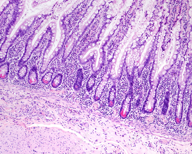 <p>Paneth cells </p>