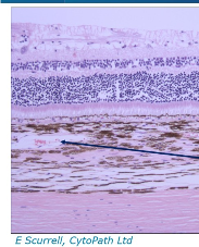 <ol><li><p>vitreous (top)</p></li><li><p>Retina (middle)</p></li><li><p>Blood vessels in the choroid</p></li><li><p>sclera</p></li></ol><p></p>