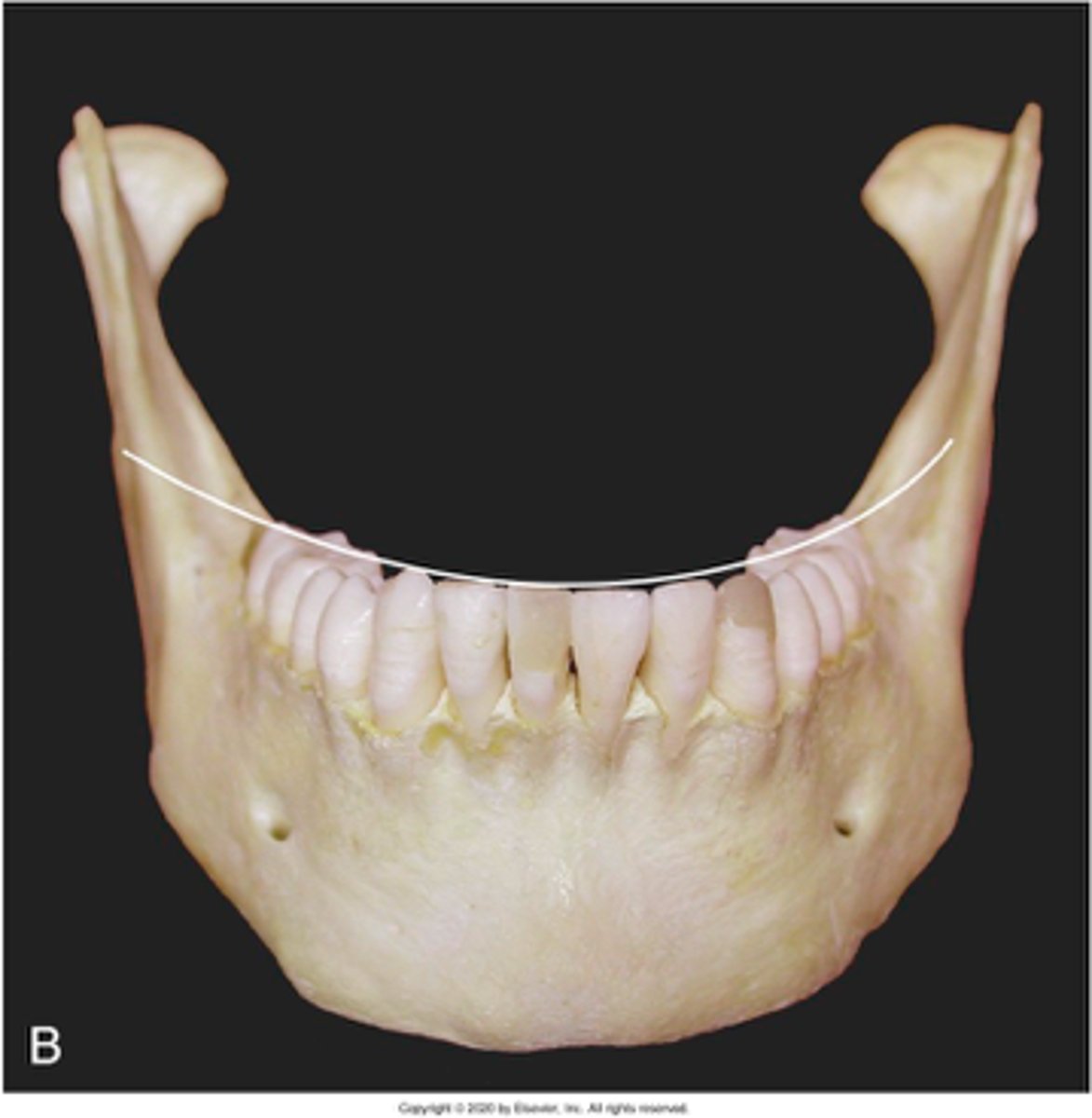 <p>which occlusal plane is observed?</p>