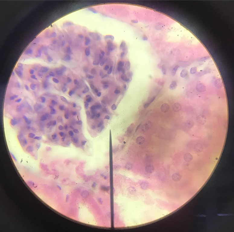 <p>flattened, polygonal in shape; nucleus is round/oval and located at the center; boundary maybe irregular or smooth; cytoplasm is barely visible but maybe seen in the vicinity of the nucleus where it appears to bulge; found on the parietal layer of the Bowman’s capsule in the kidney/ lining of blood vessels, heart, and lymphatic ducts (endothelium)/ lining of the peritoneal, pleural, and pericardial cavities as serous membranes (mesothelium)</p>