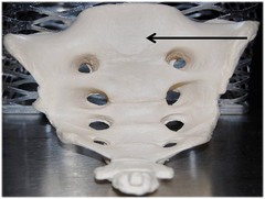 5 fused vertebrae