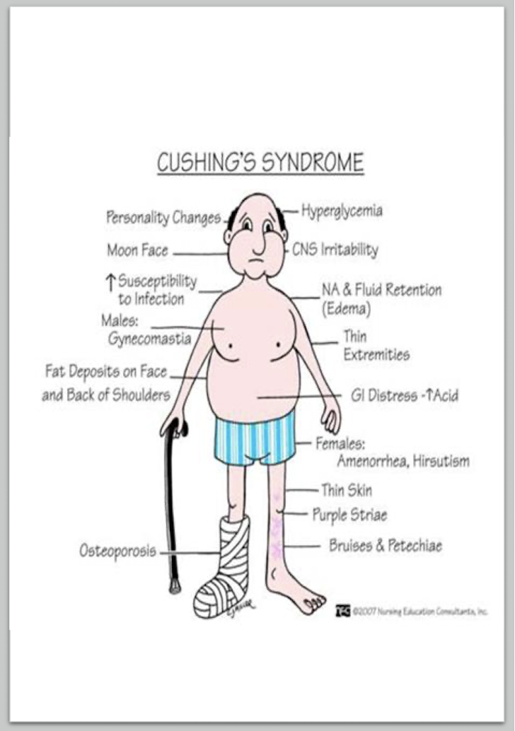 <p>Cushing’s Syndrome:</p><ul><li><p>6 Other Symptoms:</p></li></ul><p></p><p></p>