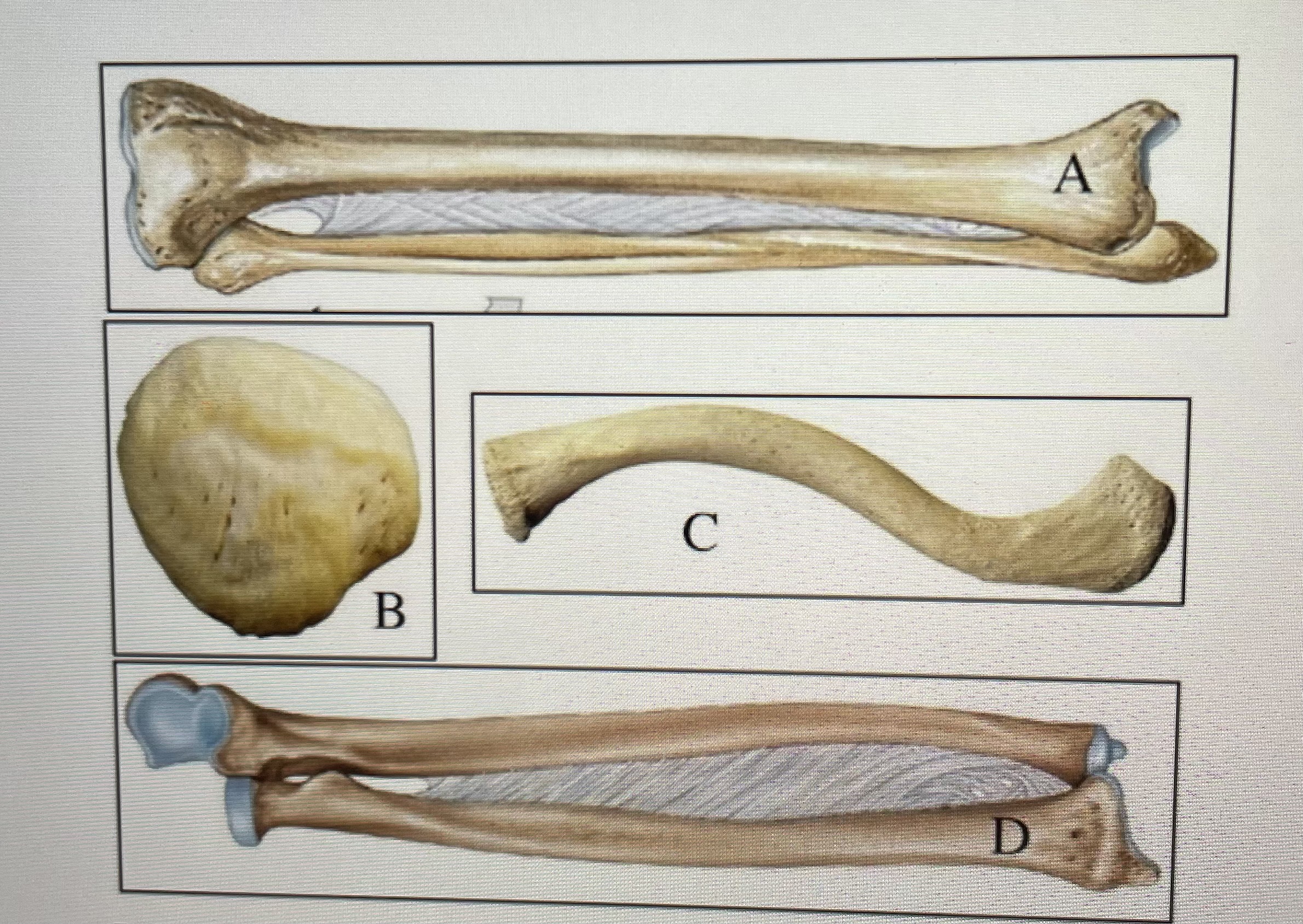 Based on the figure above identify each bone 