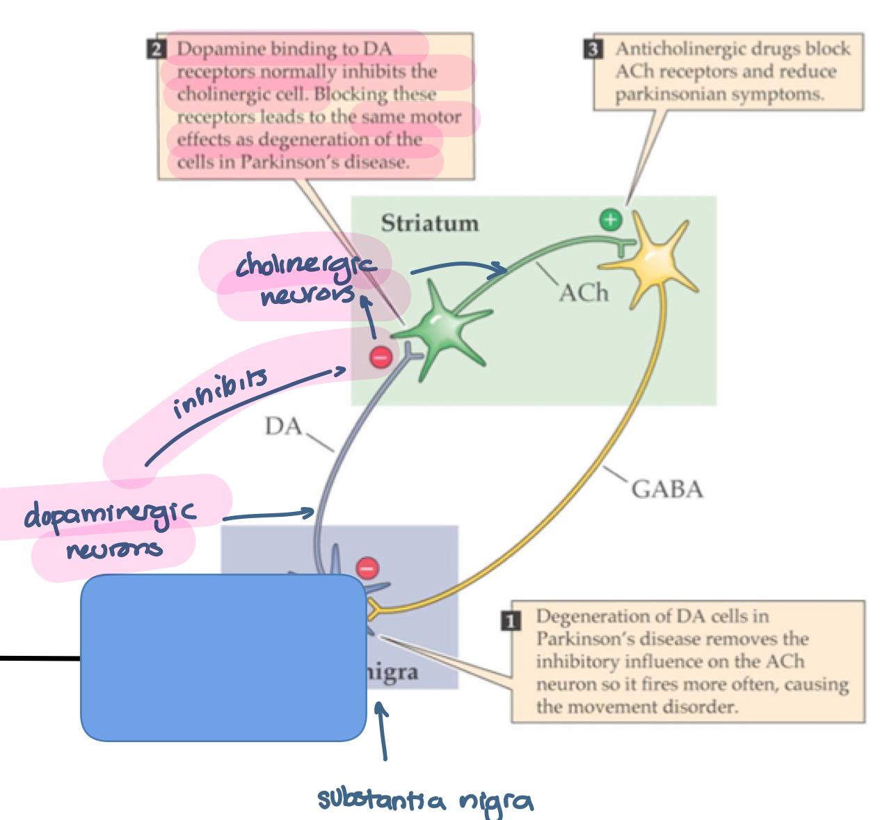 <p>management of acute dystonia associated with central D2 receptor blockade</p><p>e.g. diphenydramine</p><ol><li><p>Degeneration of DA cells in Parkinson’s disease removes the inhibitory influence on the ACh neuron so ti fires more often, causing the movement disorder</p></li><li><p>Dopamine binds to DA receptors normally inhbitors the cholinergic cell. Blocking these receptors lead to the same motor effects as degeneration of the cells in Parkinson’s disease</p></li><li><p>Anticholinergic drugs block ACh receptors and reduce Parkinsonian symptoms </p></li></ol>