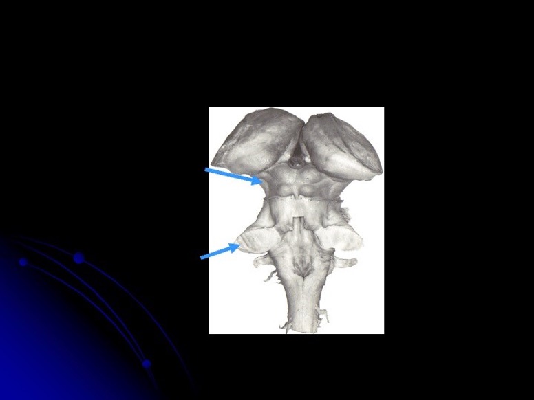 <p>what is the first arrow</p>