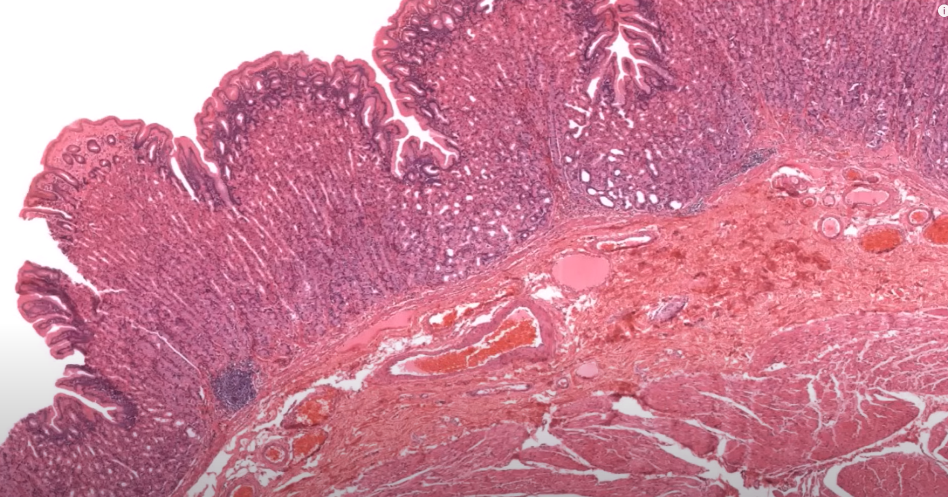 <p>Organ?</p><p>What is the name of the glands in mucosa layer?</p><p>Possibly transition from this organ to another may indicate what structure?</p>