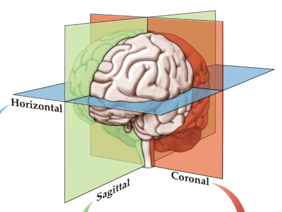 <ul><li><p>horizontal</p></li><li><p>coronal - vertical, front/back view of brain</p></li><li><p>sagittal - vertical, side view of brain</p></li></ul>