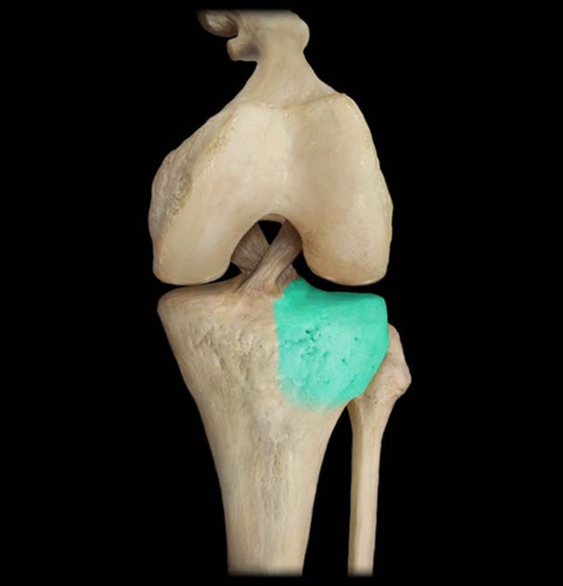 <p>lateral plateau. </p><p>where tibia articulates with the lateral condyle of the femur via the lateral meniscus (fibrocartilagenous disc)</p>