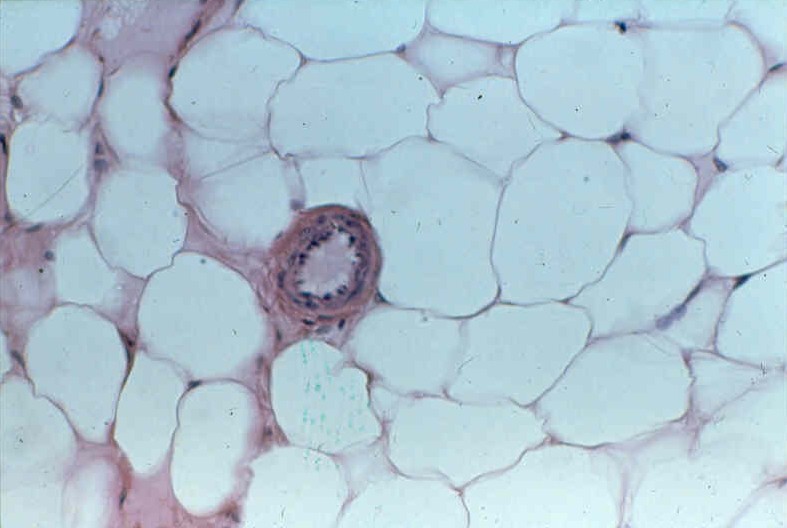 <p>What type of tissue is this</p>