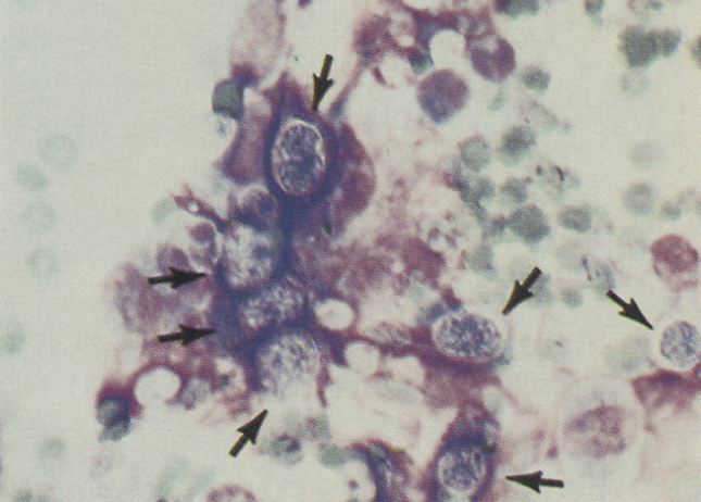 term image