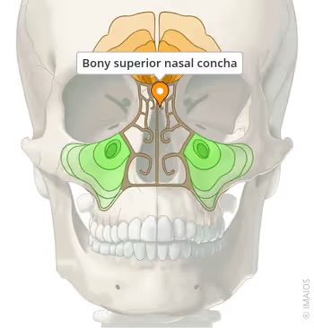<p>ethmoid</p>