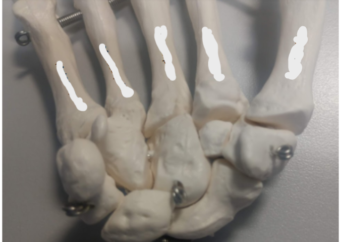 <p>What are these parts of bone from the thumb (right to left)?</p>