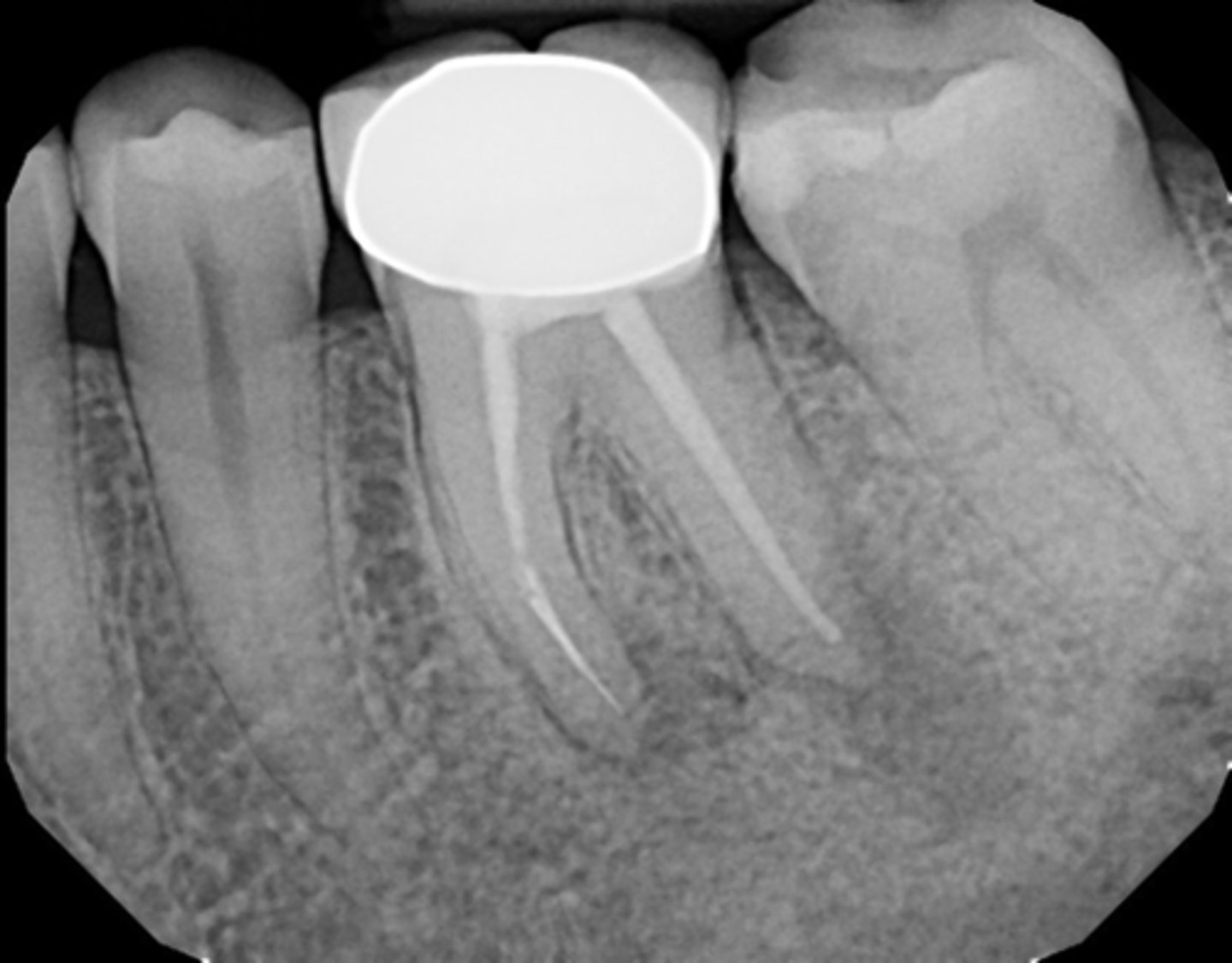 <p>ID the procedural error:</p>