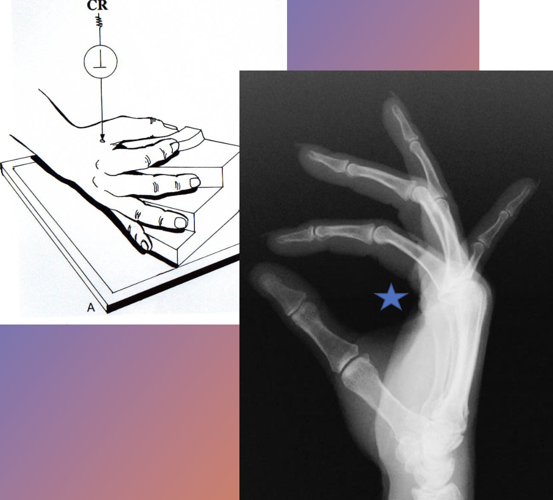 <p>lateral fan (hand)</p>