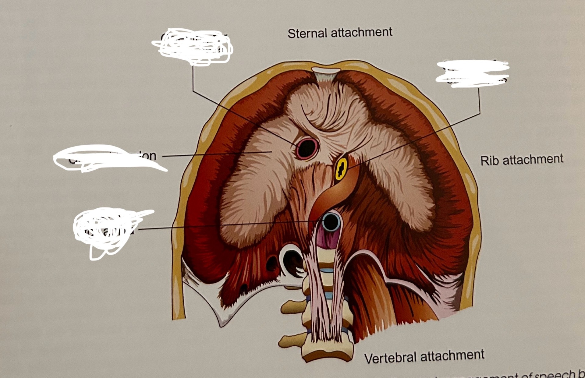 term image