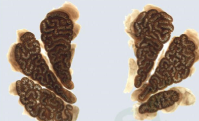 <p>What genera of botfly does this spiracle belong to?</p>