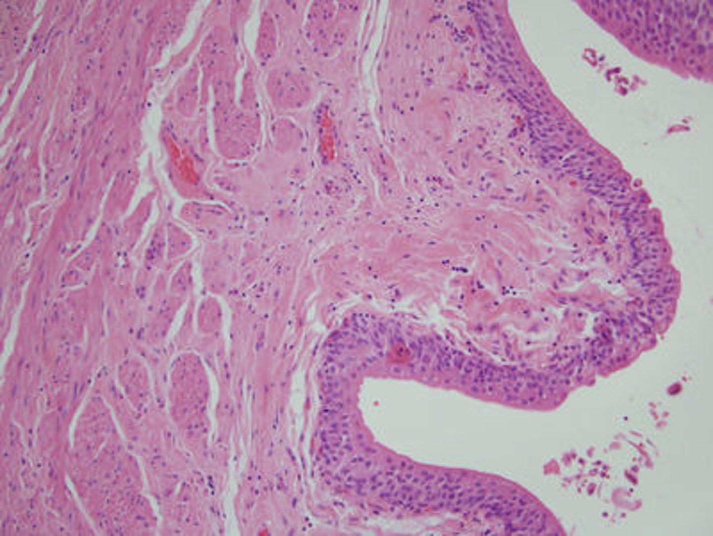 <p>hollow, muscular sac that holds and stores urine lined with transitional epithelial cells</p>