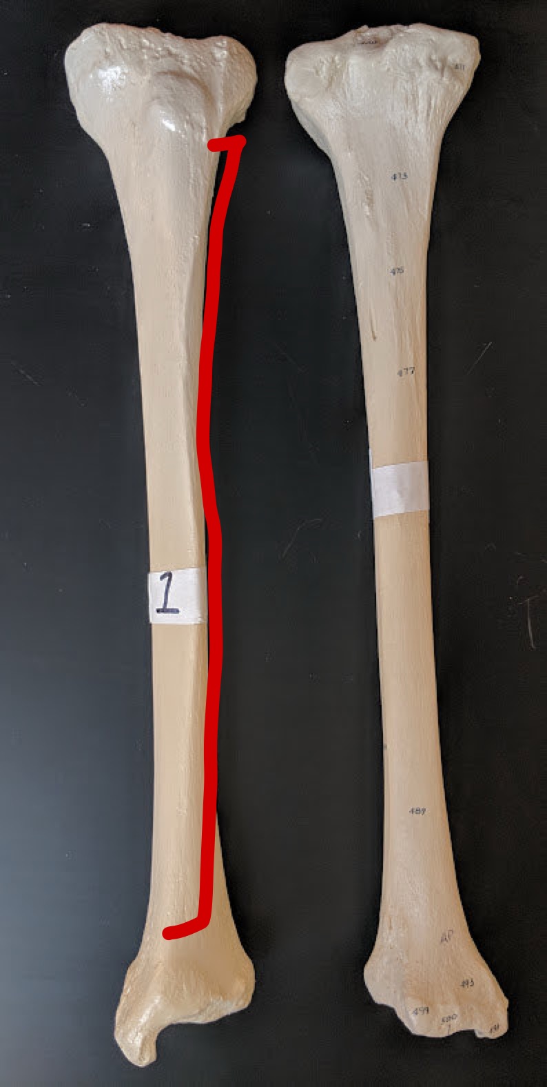 <p>Name this structure</p>