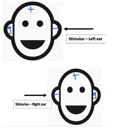 <p>Inverting= negative; non inverting= positive; ground=neutral</p><p></p>
