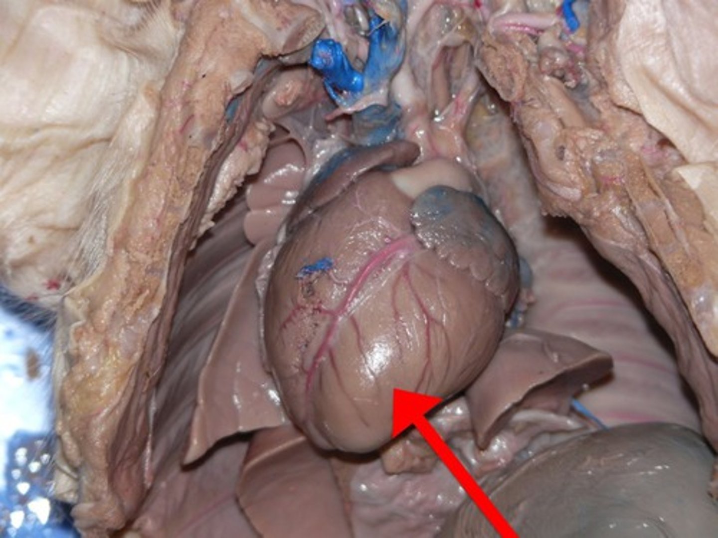 <p>The chamber of the heart that receives arterial blood from the left atrium and pumps it into the aorta.</p>