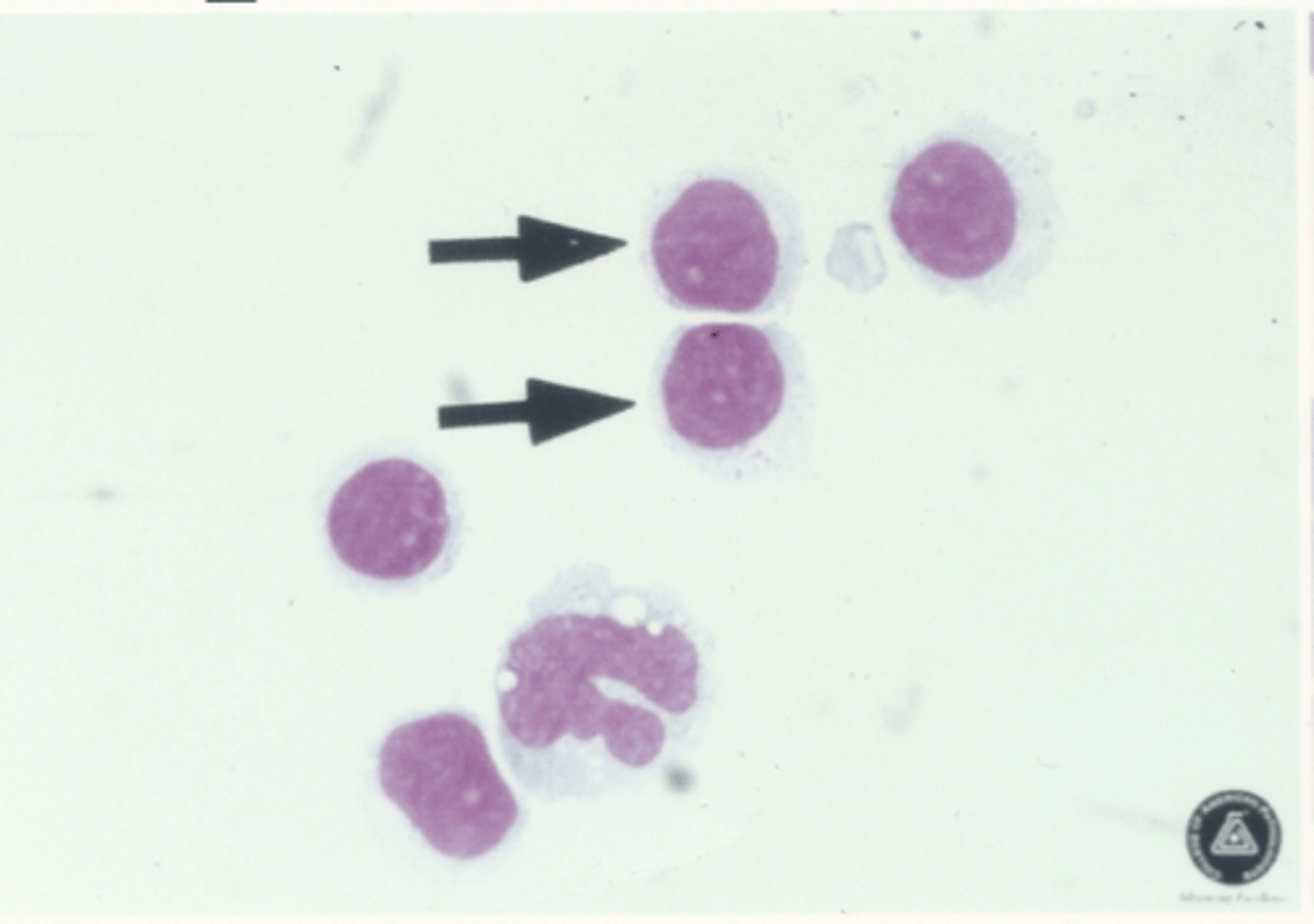 <p>Identify the cells in this body fluid</p>