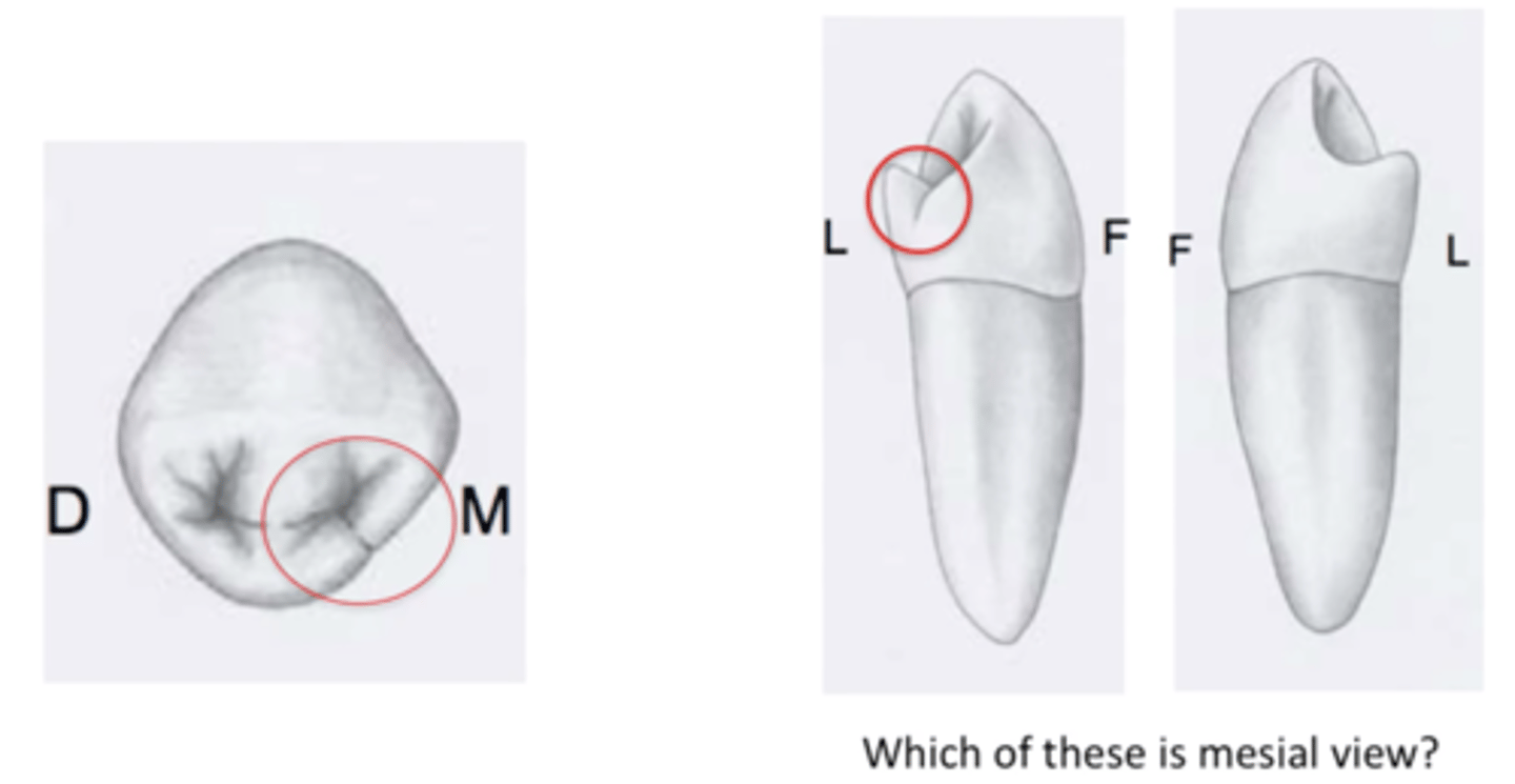 <p>- diamond in shape</p><p>- SEVERE LING. CONVERGENCE (3 mil, usually 1 mil)</p><p>- mesial outline slightly curved (in contact with canine mesially!)</p><p>- distal outline convex</p><p>- EVERYTHING SHIFTED LINGUALLY</p><p>elev</p><p>- has transverse ridge (connects △ ridges of B and L cusps)</p><p>- 2 cusps (B + L)</p><p>dep</p><p>- central dev groove v. shallow</p><p>- in m+d △ fossae, have true pits. SNAKE EYES:)</p><p>- MLDG - mesio lingual developmental groove</p>