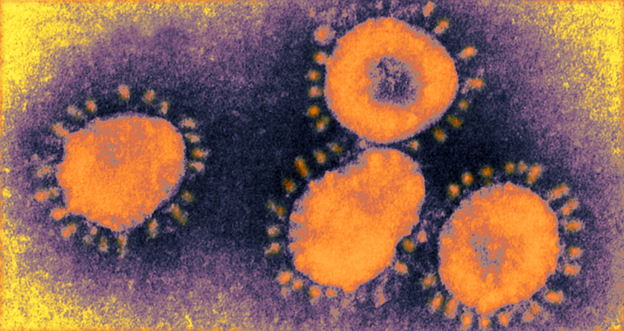 the photo below shows the virus SARS-CoV-2, which causes COVID-19, is 0.1 micrometers in size. the photo was taken with a ________ microscope 