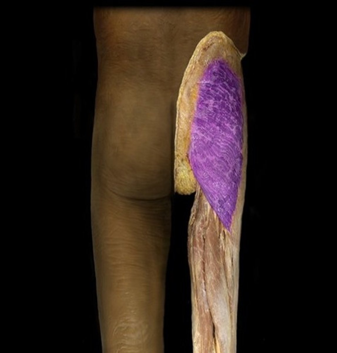 <p>Ilium posterior to gluteal line; dorsal surface of sacrum and coccyx; sacrotuberous ligament</p>