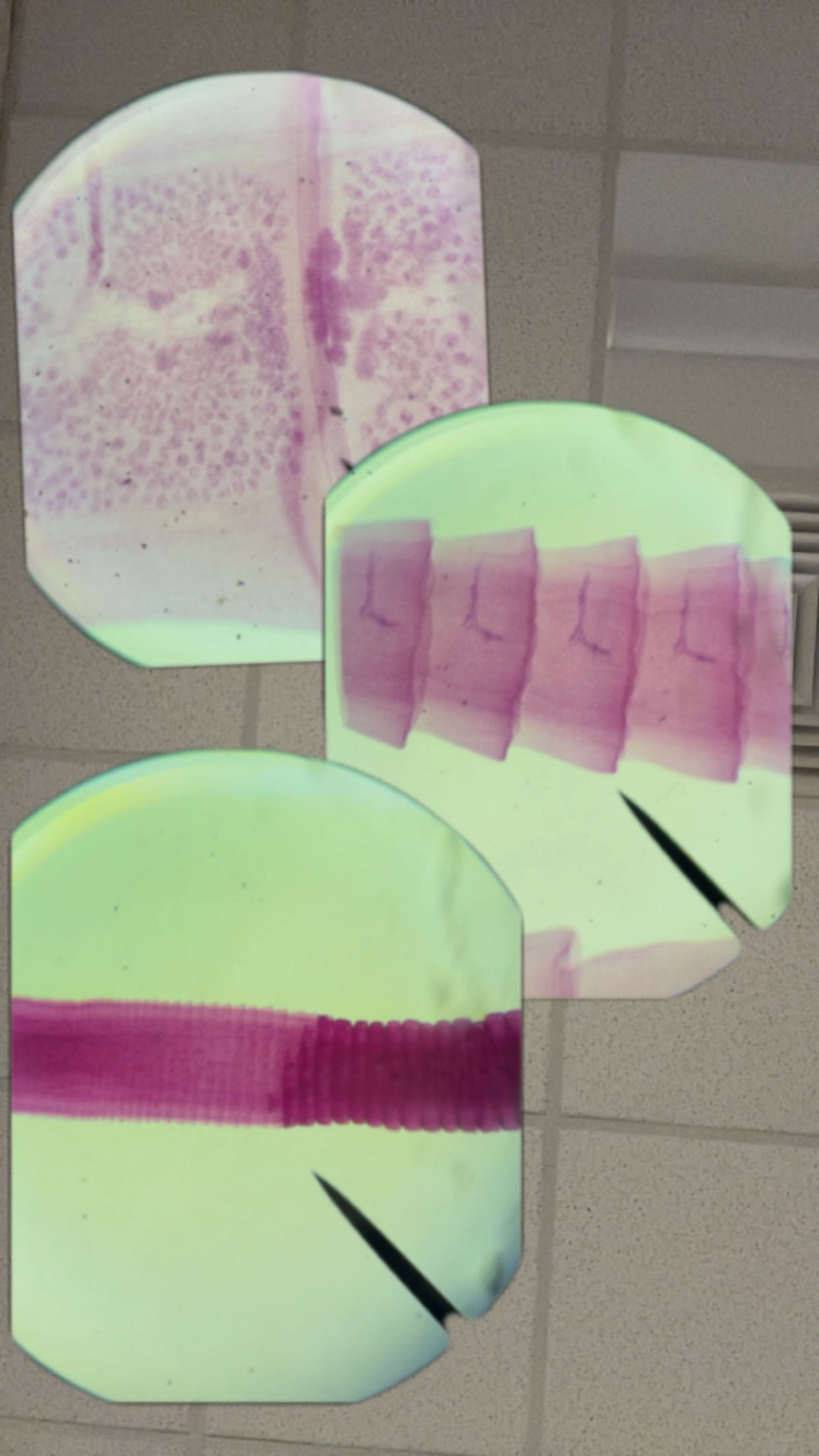 <p>Identify the organism and the Class it belongs to</p>