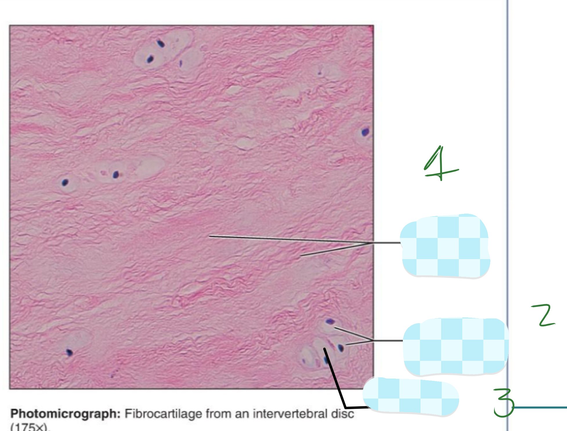 <p>1) fibrocartilage</p>