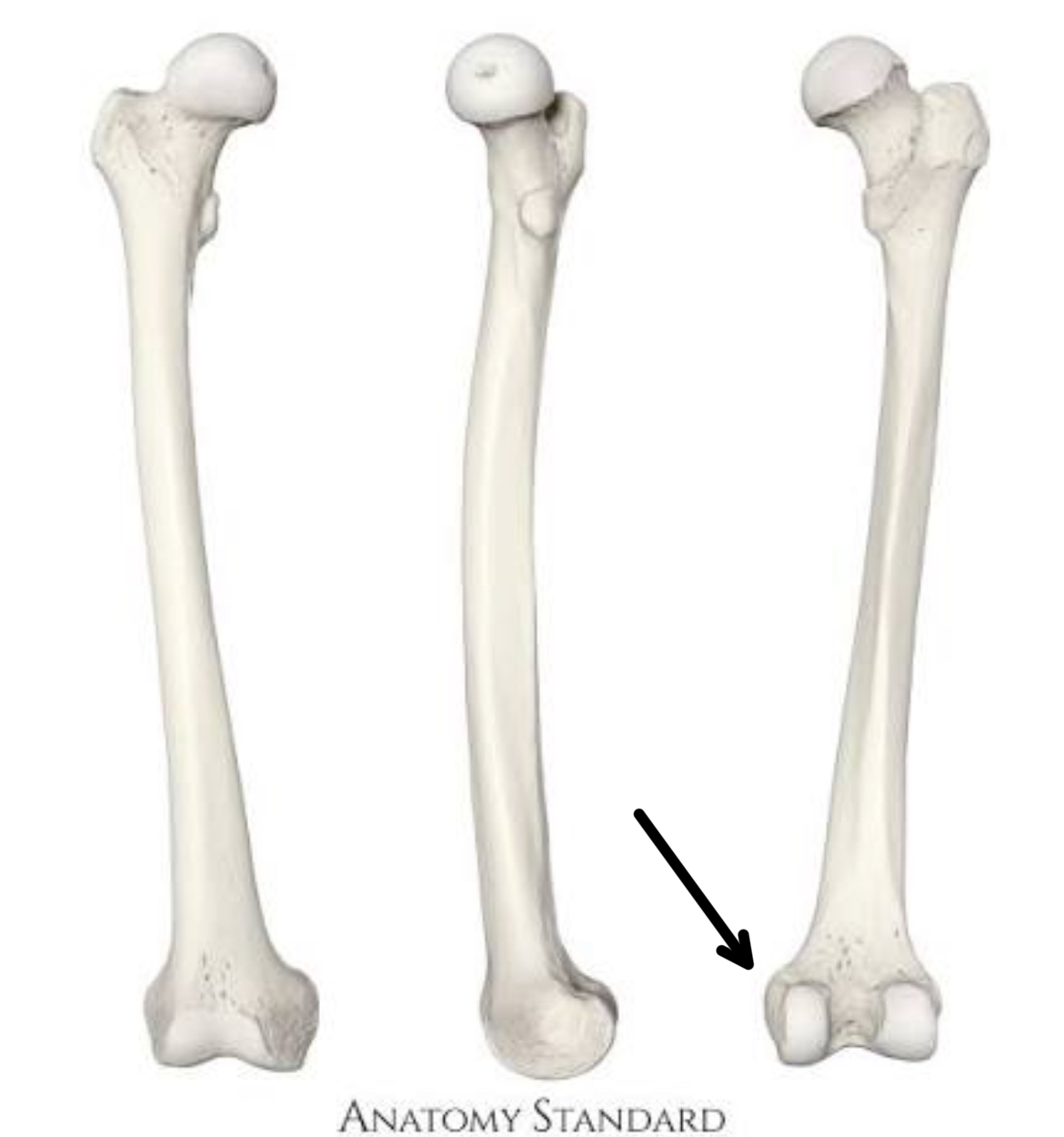 <p>what part of the femur is this?</p>