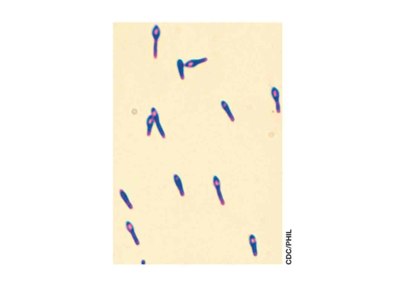 <p>Lives in tiny anoxic pockets within soil but also in anaerobic canned foods, secreting exoenzymes to degrade plant material and producing deadly botulism-causing neurotoxin.</p>