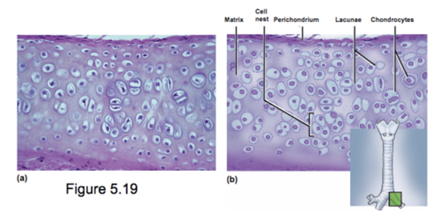 <p>Most common type of cartilage</p><p>Clear glassy matrix because of unusual fineness of collagen fibers</p>