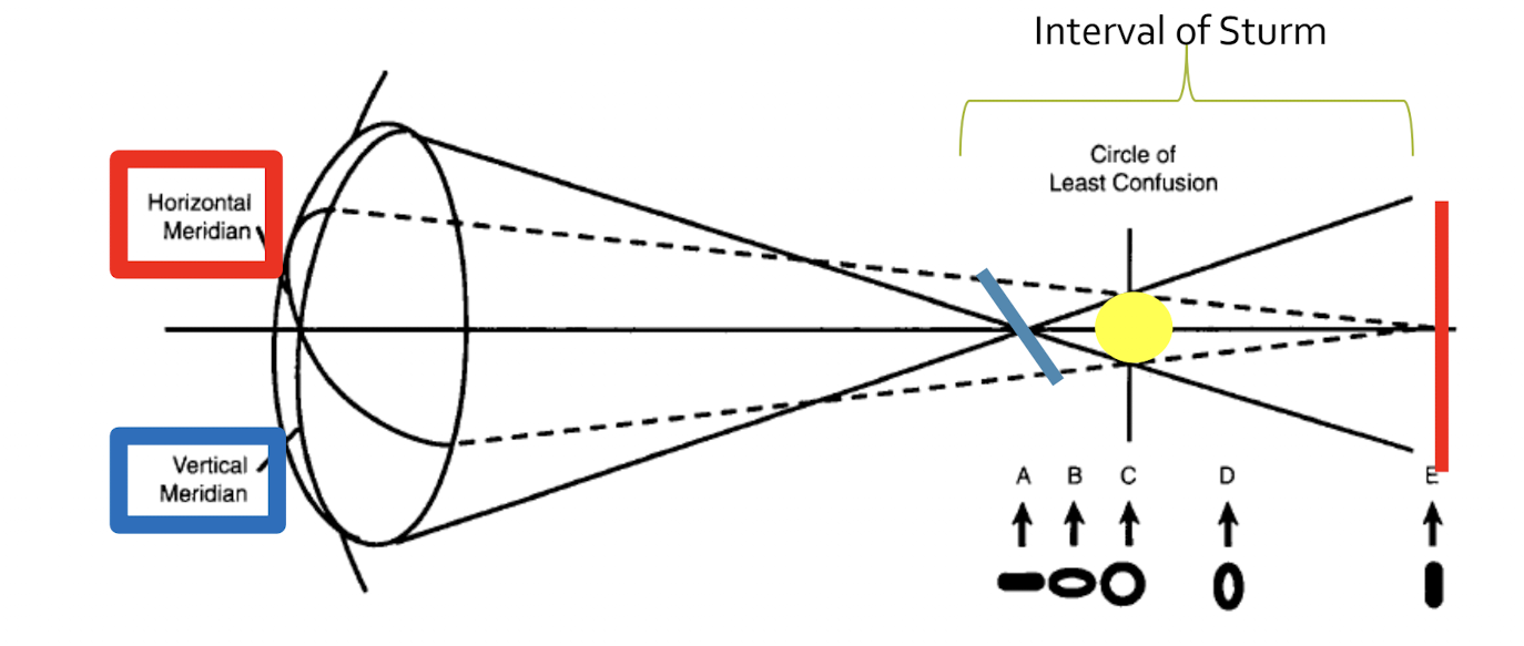 <p>Dioptric midpoint between the horizontal and vertical focal lines <br>Keeping the CLC centered over the patient’s macula during refraction provides the best vision in both meridians to elicit accurate responses from the patient. </p>