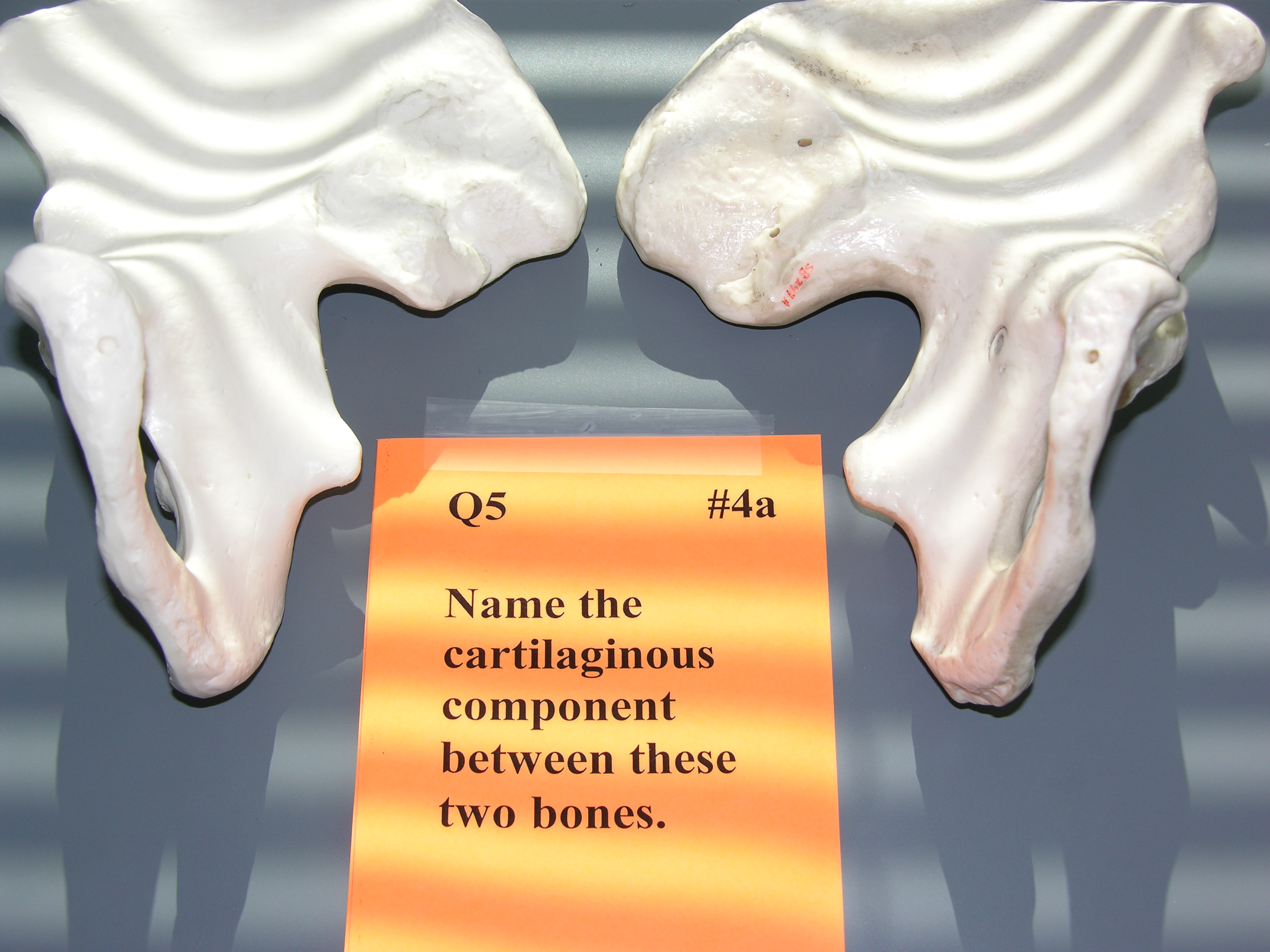 <p><span style="font-family: Lato Extended, Lato, Helvetica Neue, Helvetica, Arial, sans-serif; color: rgb(45, 59, 69)">The cartilaginous component found between these two bones is part of which joint?</span></p>